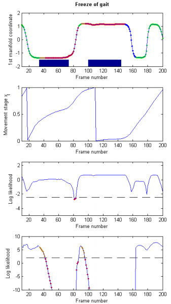 Example of results on FoG gait